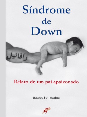 cover image of Síndrome de Down